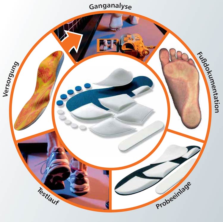 Sensomotorische Einlagen Versorgungsablauf